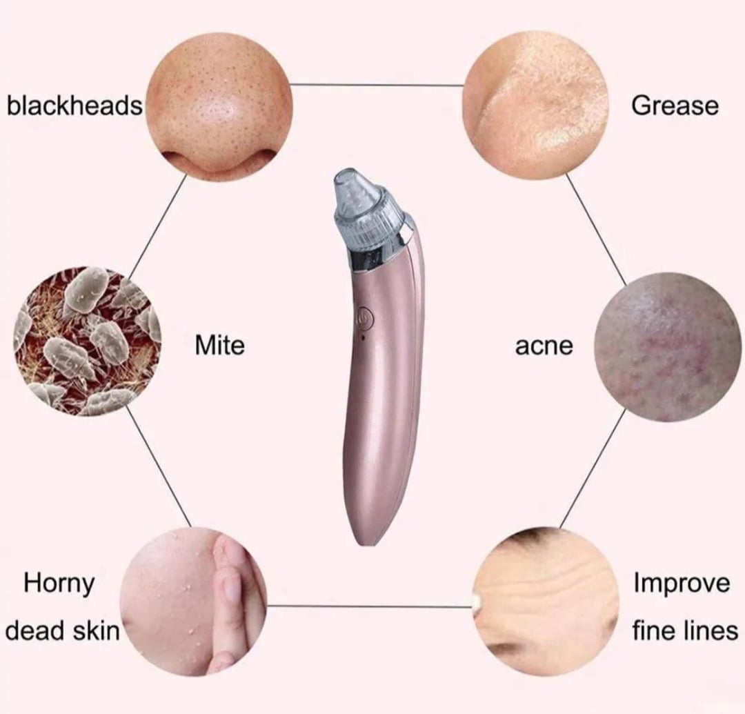 Máquina para eliminar puntos negras