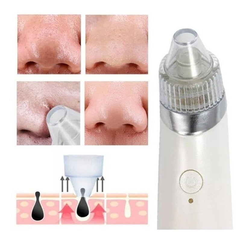 Máquina para eliminar puntos negras